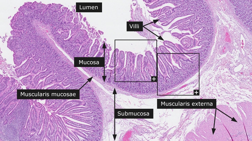 Pathophysiology - Gut Smart